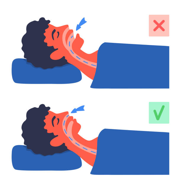 Risk Factors of Sleep Apnea